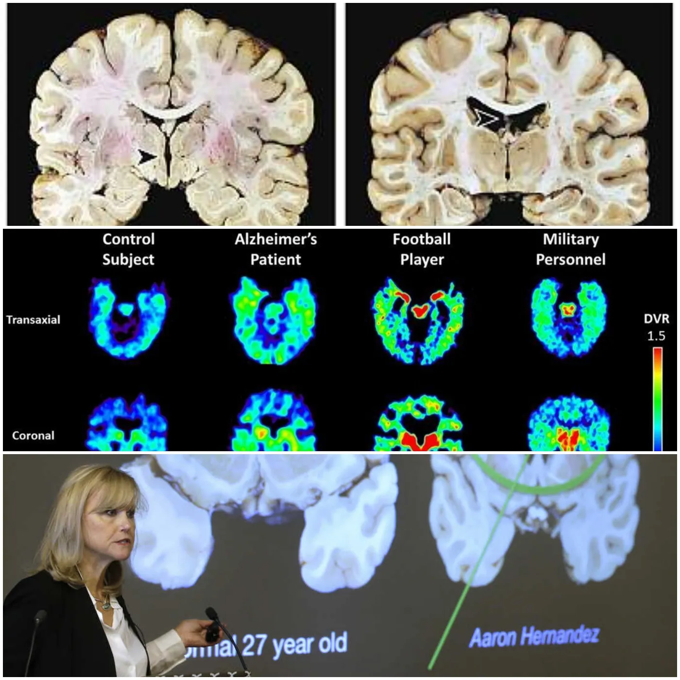 image_67374ca806e3a UFC Invites Key Stakeholders to Inaugural “Brain Health Education Summit” Amid Growing CTE Concerns