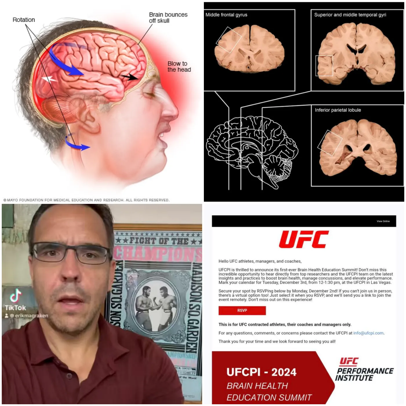 image_67374caa1ccc3 UFC Invites Key Stakeholders to Inaugural “Brain Health Education Summit” Amid Growing CTE Concerns